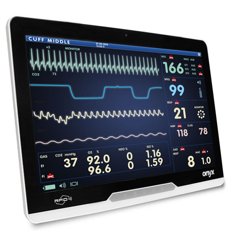 Onyx Mate2 24&ldquo;, i5-13500TE, 16GB RAM, kapazitiv, 512GB SSD, WiFi6E